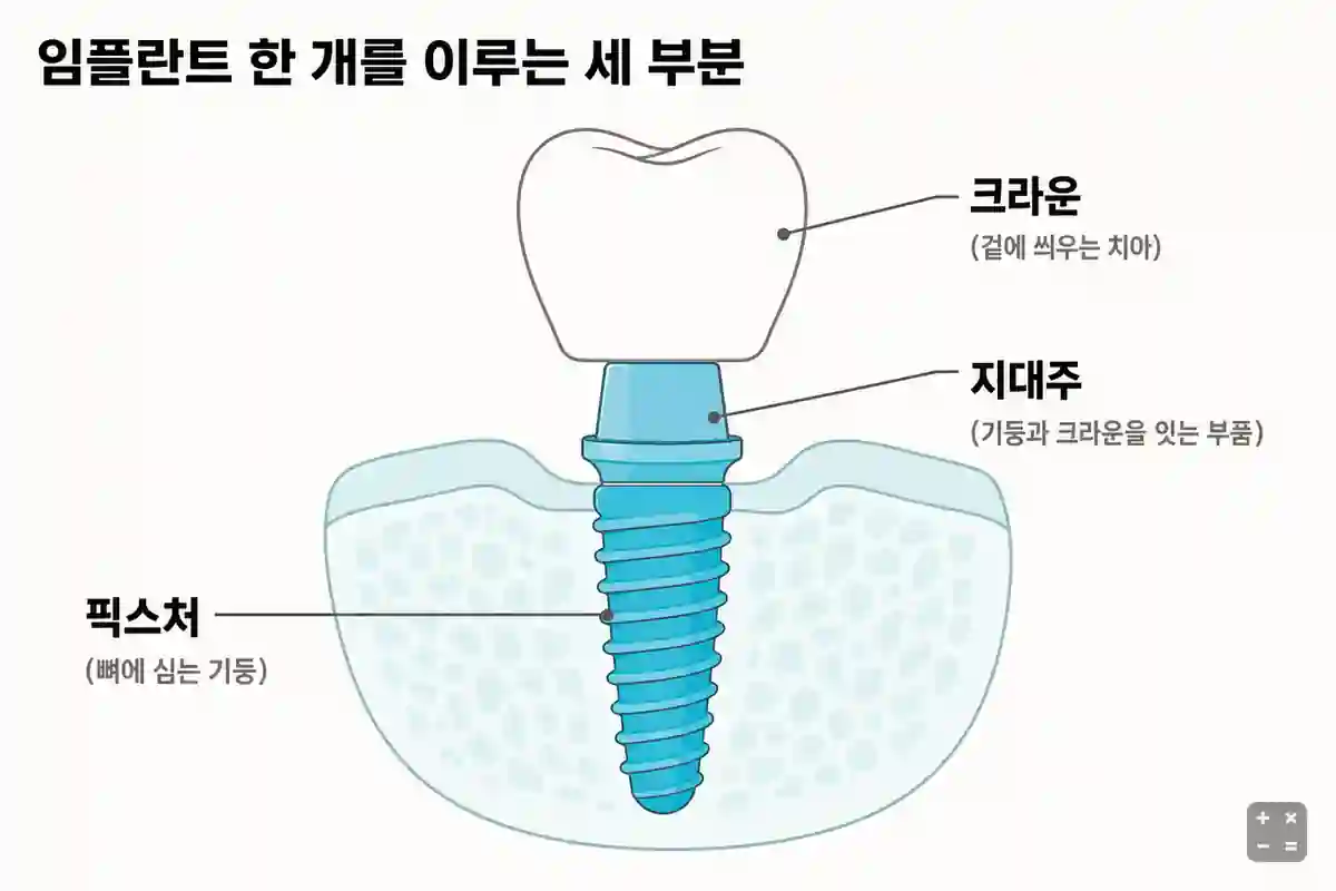 임플란트 한 개를 이루는 픽스처·지대주·크라운